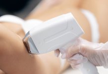 De ce epilarea definitivă cu laser Soprano Ice Titanium este noul standard în estetică?